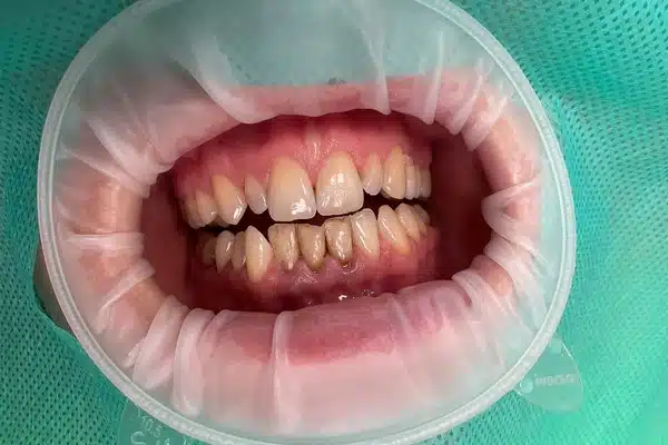 /